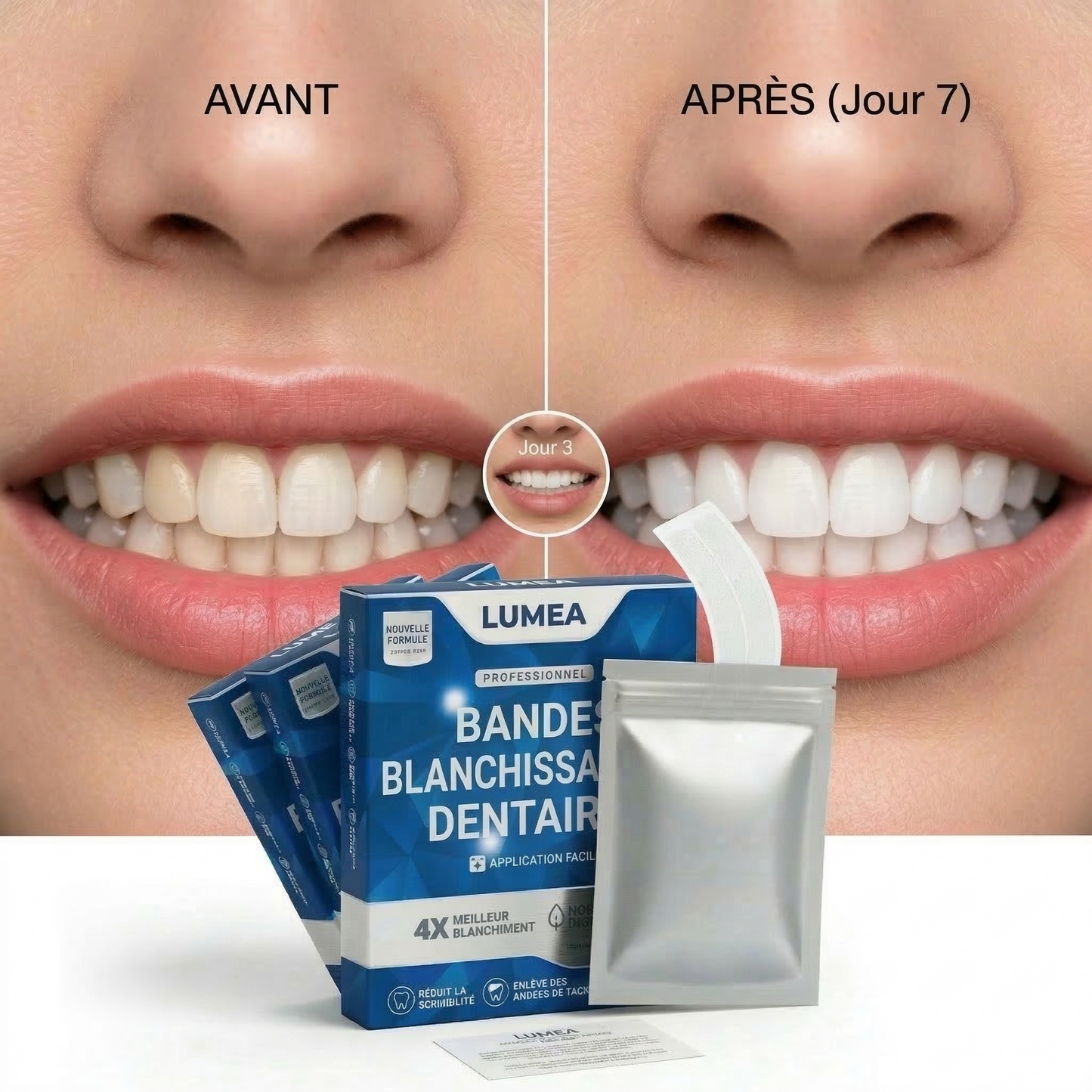 Bandes blanches de blanchiment dentaire Lumea™